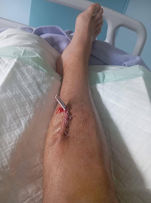 Final del festejo: Damián Castaño corta una oreja y acaricia la puerta grande en una tarde épica en Santander