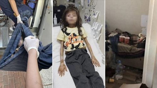 Aile ve Sosyal Hizmetler Bakanlığından Bursa'da çöp evde bulunan çocukla ilgili açıklama